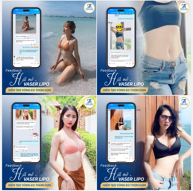 Cảm ơn các chị em đã luôn tin tưởng lựa chọn Thẩm mỹ Tuấn Anh là điểm đến để thực hiện ước mơ sở hữu một vòng eo thon gọn, quyến rũ.