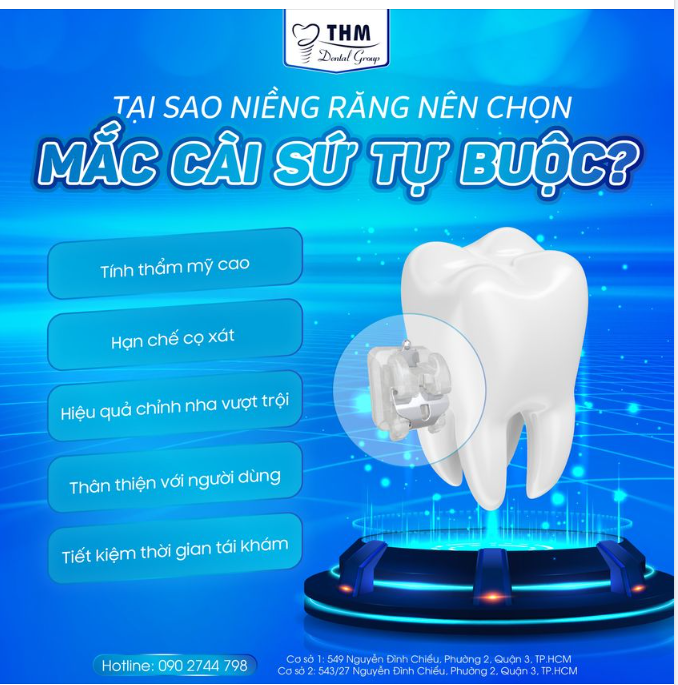 TẠI SAO NIỀNG RĂNG NÊN CHỌN MẮC CÀI SỨ TỰ BUỘC?