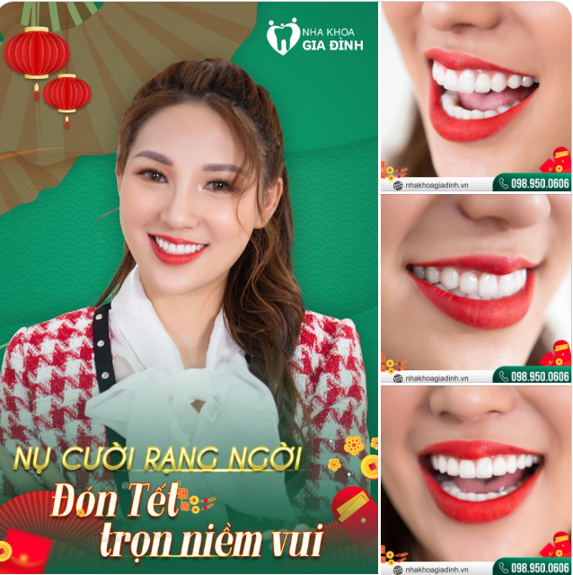 KHOE SẮC NỤ CƯỜI - RẠNG RỠ ĐÓN XUÂN