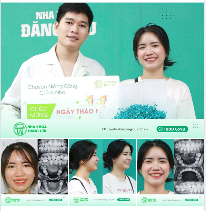 ĐÃ CÓ AI BẢO EM CƯỜI LÊN TRÔNG RẤT XINH CHƯA?