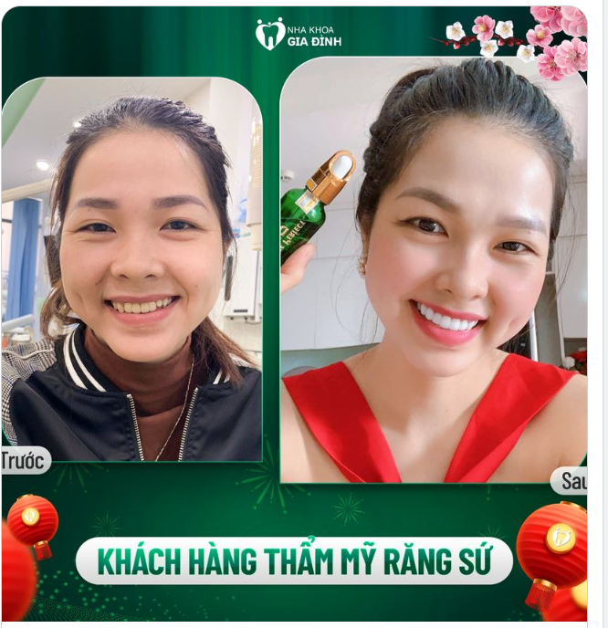 BẠN ĐÃ CHỜ ĐỢI QUÁ LÂU RỒI. GIỜ HÃY THAY ĐỔI ĐI!!