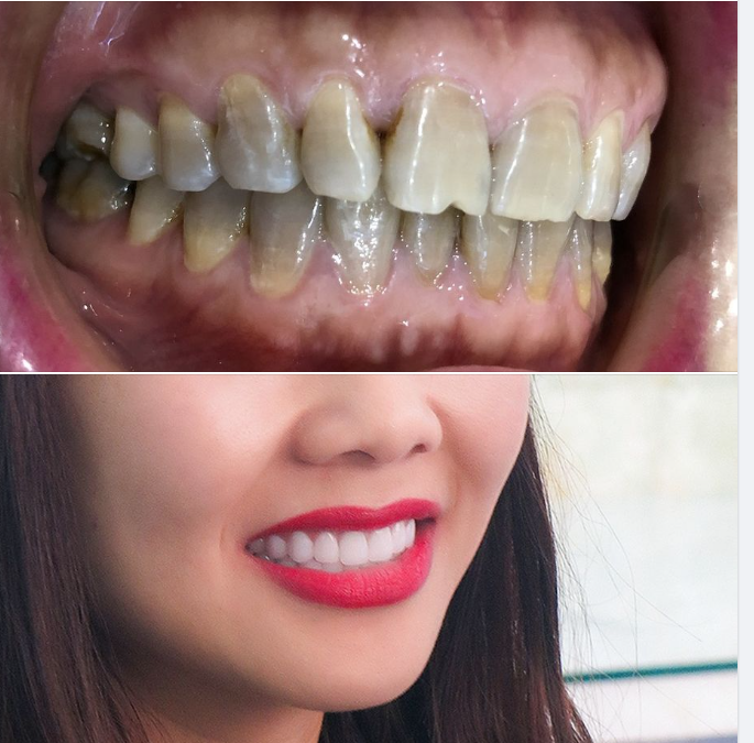 Một chỉ định và sự lựa chọn phù hợp