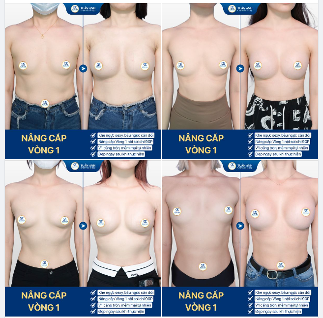 Bác sĩ Tuấn Anh CKI với hơn 16 năm kinh nghiệm - Top đầu ngành phẫu thuật thẩm mỹ sẽ giúp bạn sở hữu: