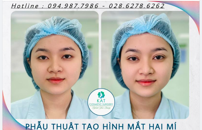 “Một đôi mắt đẹp có thể thay đổi thần thái gương mặt như thế nào? 