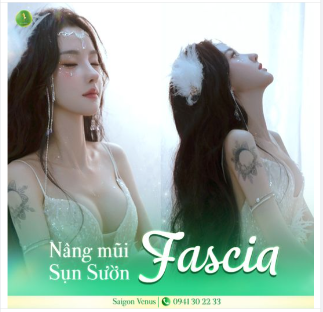 FEEDBACK CỦA CÔ NÀNG MỸ MỸ SAU 1 THÁNG NÂNG MŨI