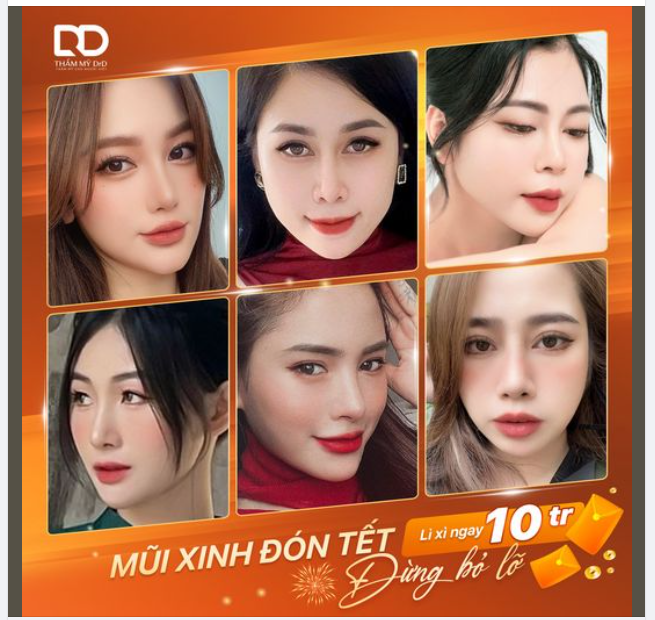 MŨI XINH ĐÓN TẾT, LÌ XÌ NGAY 10TR