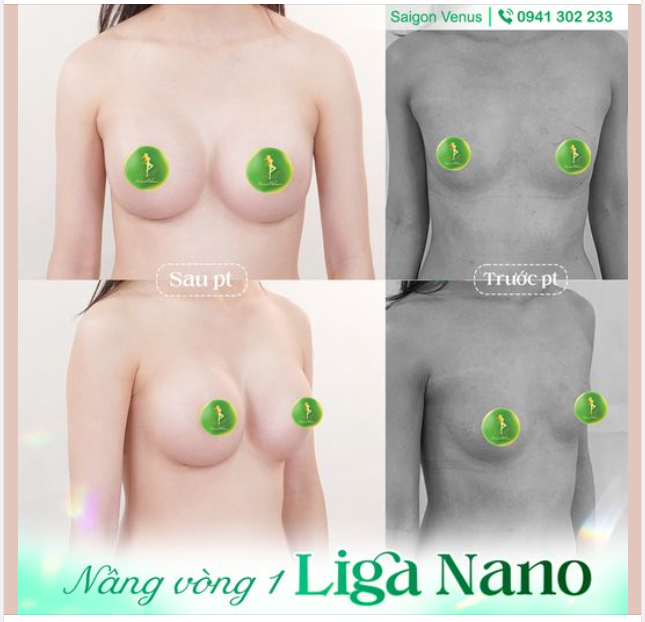 V1 ĐỨNG FORM, KHE SÂU, CĂNG TRÒN ĐÚNG CHUẨN TỶ LỆ VÀNG