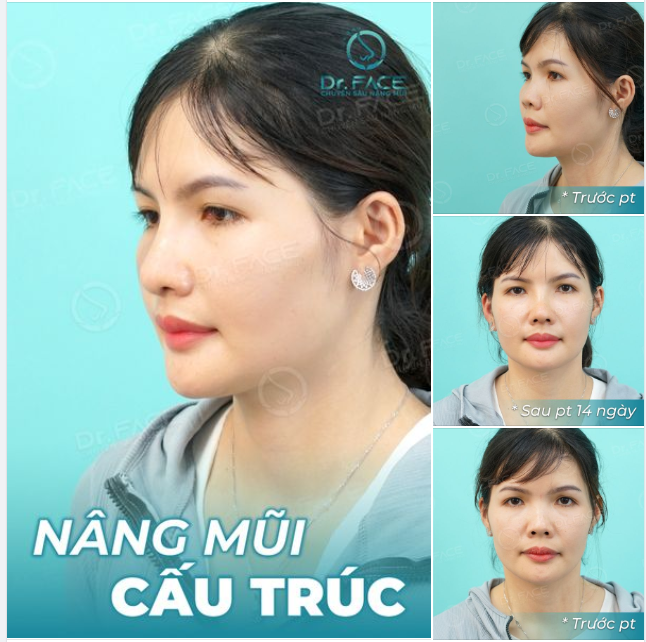 Nghe nói hôm nay trời trở gió. Em đi đâu đó, nhớ mang anh theo…!