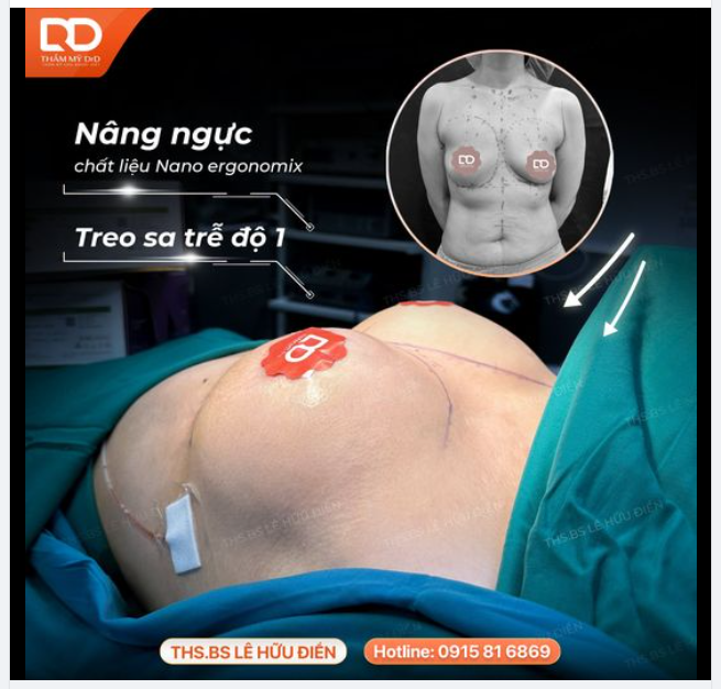 Không còn nhỏ xệ, tròn đẹp thích mê.