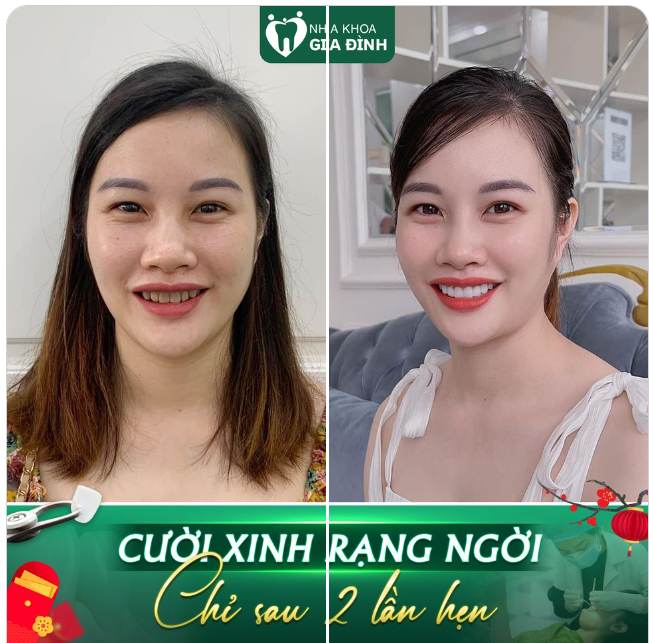 TÂN TRANG NỤ CƯỜI TRƯỚC TẾT, CÒN GÌ TUYỆT VỜI HƠN!!!