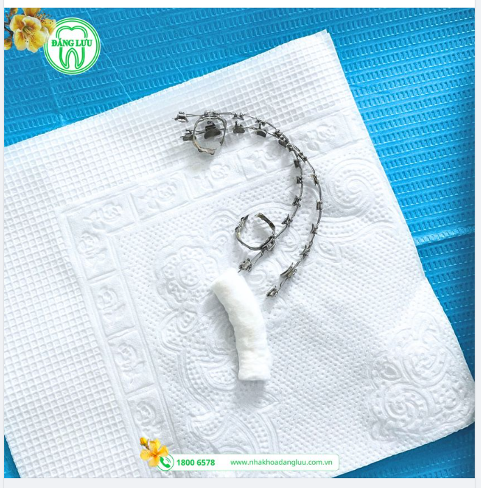 Bổ quả cau, Niềng-er Đăng Lưu trong năm 2024 này sẽ: