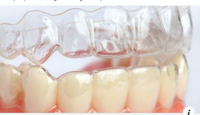 Giải pháp điều trị nghiến răng hiệu quả