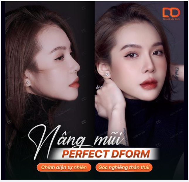 Tết đến SALE về - Nâng mũi chi phí siêu hời