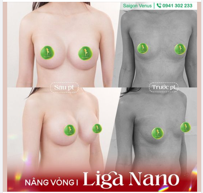 VÒNG 1 XINH, LUNG LINH ĐÓN TẾT