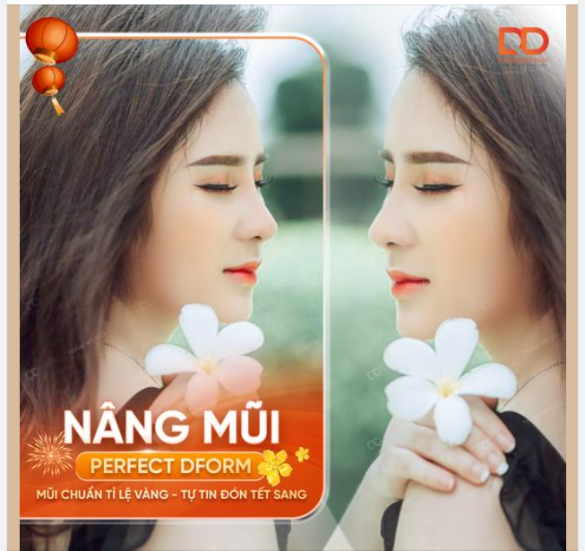 Nâng mũi Perfect Dform đang là xu hướng thịnh hành nhất hiện nay bởi: Dáng mũi chuẩn tỷ lệ vàng, duy trì kết quả lâu dài, thời gian phục hồi nhanh chóng.