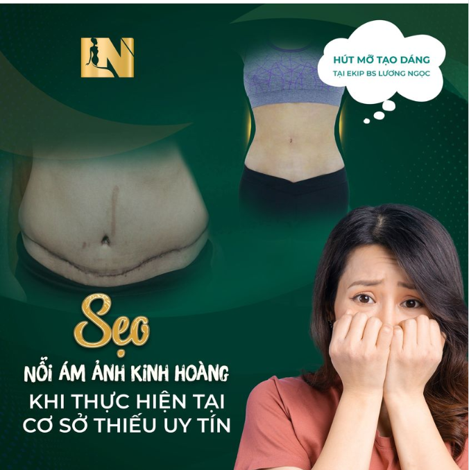 XÓA NHÒA NỖI ÁM ẢNH: SẸO - KHIẾN BẠN LO LẮNG KHI CAN THIỆP THẨM MỸ