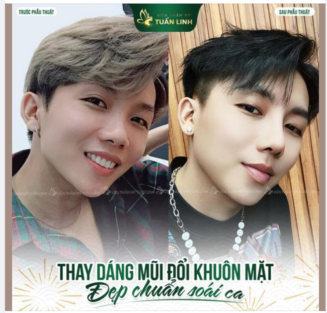 THAY DÁNG MŨI - ĐỔI KHUÔN MẶT - ĐẸP HÚT HỒN!!