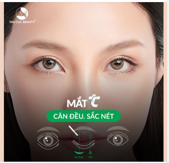 ĐẸP ĐÓN TẾT TẶNG NGAY 1CC FILLER GIÁ GỐC MẮT TC DUY NHẤT 10 SUẤT HÔM NAY