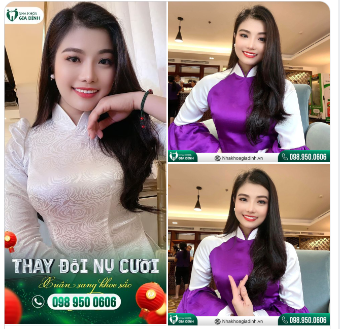 THAY ĐỔI NỤ CƯỜI - XUÂN SANG KHOE SẮC