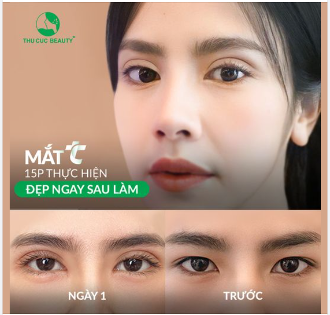 Kết quae sau 15 phút taih Thu Cúc