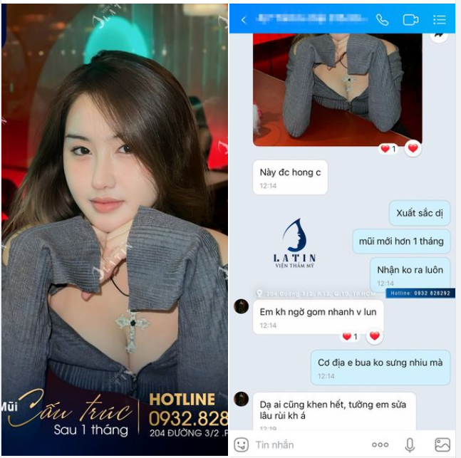 Đẹp như Hotgirl sau khi nâng mũi tại Latin