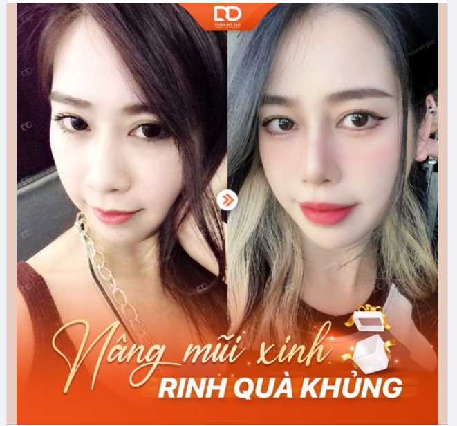 MŨI XINH RINH QUÀ KHỦNG - 20 NGÀY CÓ MŨI XINH ĐÓN TẾT