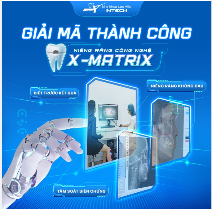 ĐIỀU GÌ ĐÃ TẠO NÊN THÀNH CÔNG CHO HƠN 40.000 KHÁCH HÀNG NIỀNG RĂNG CÔNG NGHỆ X-MATRIX?