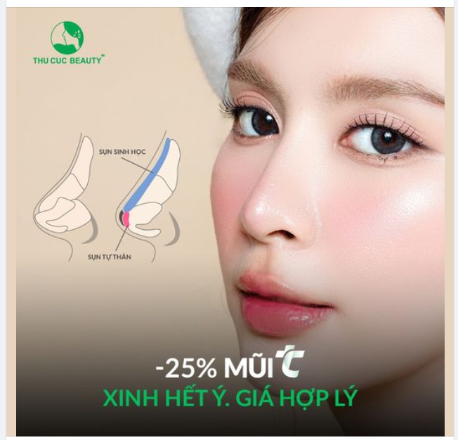 Mũi Thu Cúc nâng ngay đẹp hết ý, chi phí hợp lý