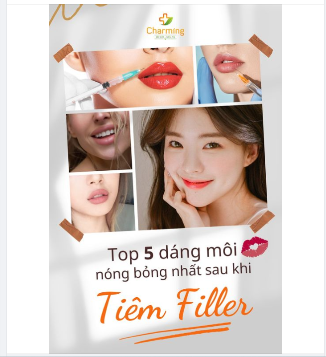 TOP 5 DÁNG MÔI NÓNG BỎNG NHẤT SAU KHI TIÊM FILLER