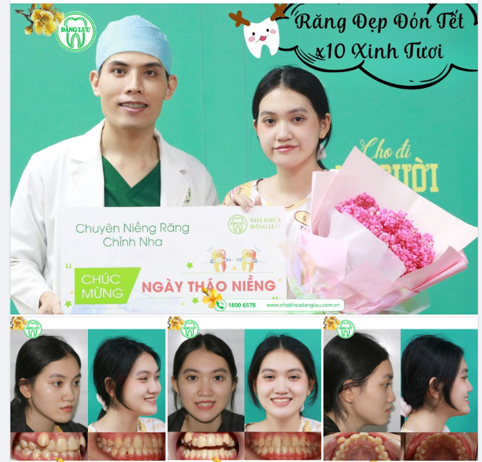 ĐÃ CÓ AI BẢO EM CƯỜI LÊN TRÔNG RẤT XINH CHƯA?