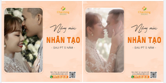Từ nay trở đi, đông có nắng ấm, hạ có gió mát, còn em ngoài có anh thì còn có chiếc mũi nhân tạo + cắt cánh mũi xinh xắn này để làm vợ anh.