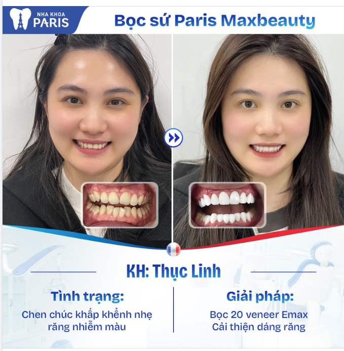 Rạng rỡ nụ cười tươi đón Tết cùng Nha khoa Paris!