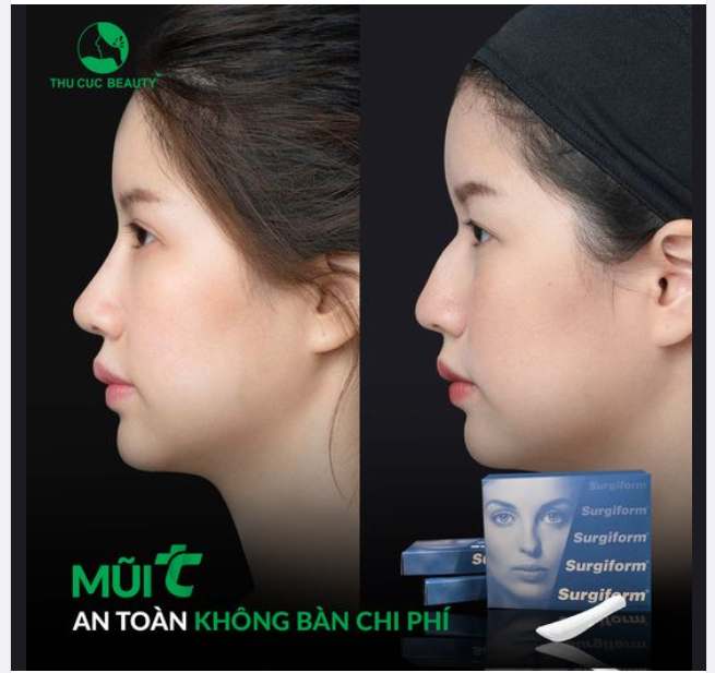30P loại bỏ sống mũi mũi gồ.  Đẹp tự nhiên cho khách hàng 