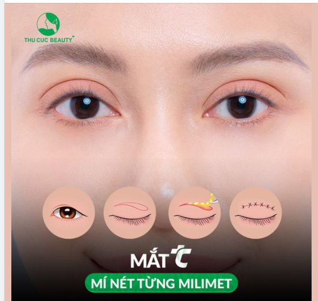 Chỉ còn 10 suất giá gốc Mắt TC hôm nay đẹp ngay đón Tết