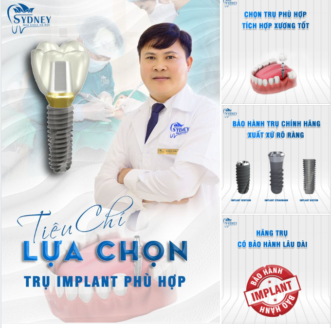 CÁC TIÊU CHÍ LỰA CHỌN TRỤ RĂNG IMPLANT PHÙ HỢP