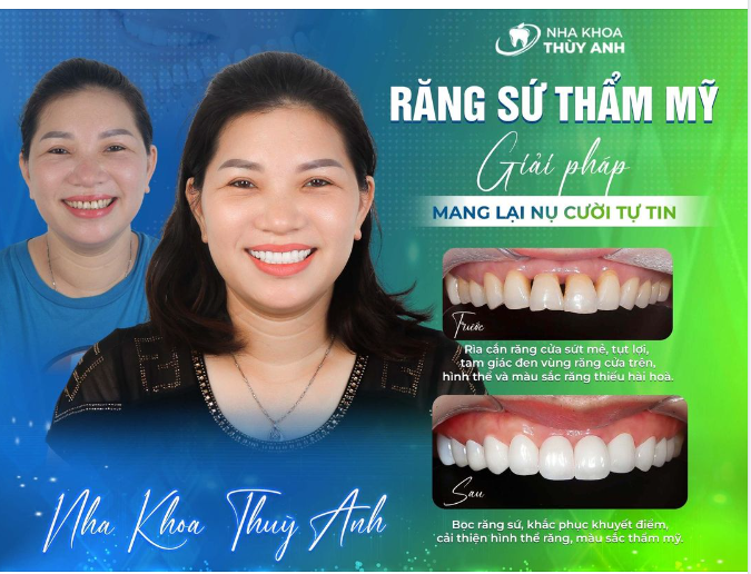 Dáng mũi là một yếu tố quan trọng trong nét đẹp của một người. Hãy cùng xem hình ảnh liên quan đến dáng mũi để tìm kiếm sự hoàn hảo cho vẻ ngoài của bạn. Từ đó, bạn có thể tìm hiểu và tham khảo những cách để cải thiện dáng mũi của mình.