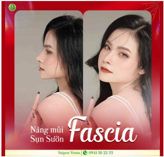 GÓC NGHIÊNG ĐỈNH CAO - TẠO HÌNH MŨI ĐẸP