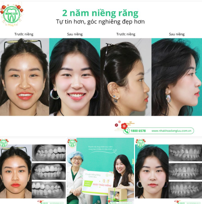 ĐÃ CÓ AI BẢO EM CƯỜI LÊN TRÔNG RẤT XINH CHƯA?