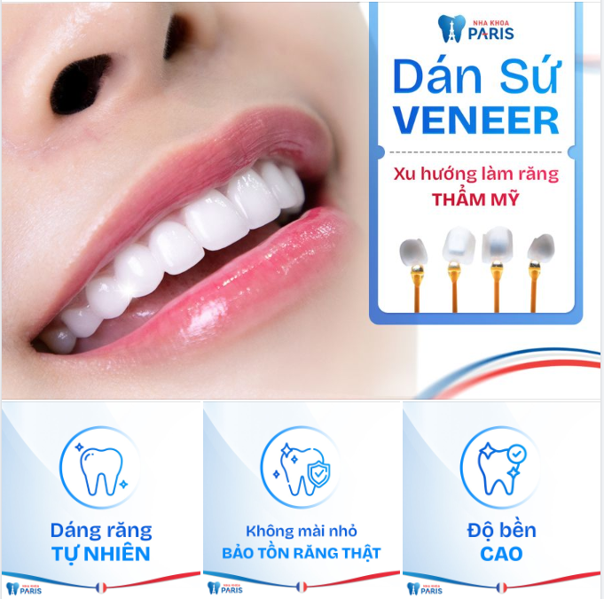 DÁN SỨ VENEER - XU HƯỚNG THẨM MỸ RĂNG SỨ
