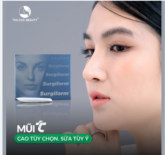 Mũi Surgiform đẹp tự nhiên cho khách hàng