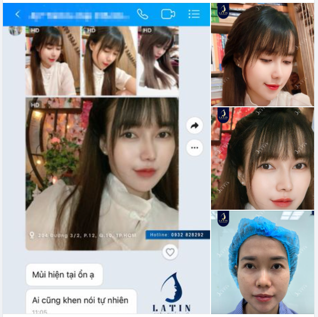 Mê mẩn dáng mũi cấu trúc gần 1 năm của em gái
