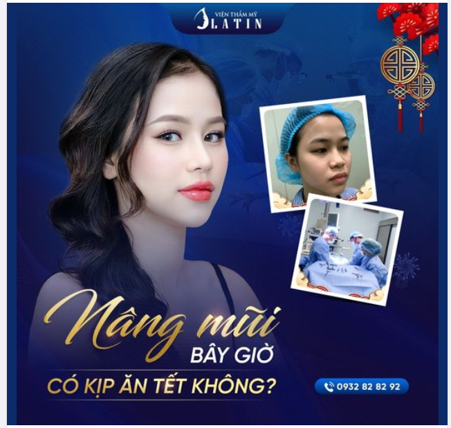 NÂNG MŨI BÂY GIỜ CÓ KỊP ĂN TẾT KHÔNG