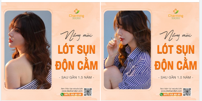 Nếu bạn cứ lăn tăn với câu hỏi "Độn cằm, nâng mũi giữ được bao nhiêu lâu?" thì nàng khách sau đây tại Charming sẽ trả lời bằng hình ảnh tuyệt vời của mình.