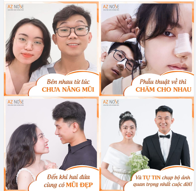 Couple cùng nâng mũi để tự tin chụp "ảnh cưới"!!