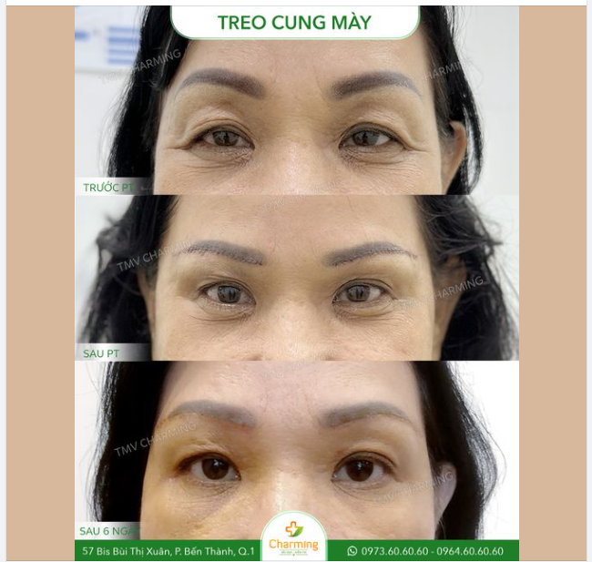 Treo cung mày dường như không còn xa lạ với các "fan cứng" của TMV Charming rồi đúng không nào?
