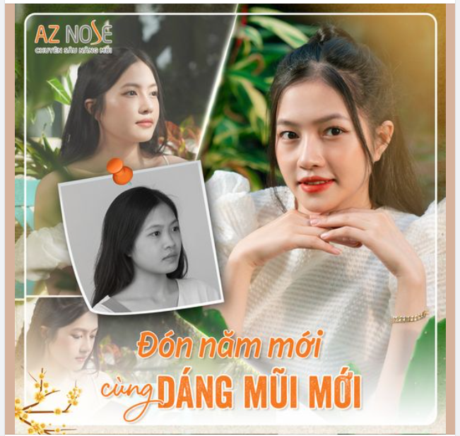 Gen Z "đẹp trong trẻo" với dáng mũi 20 ngày