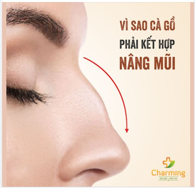CÀ GỒ KHÔNG ĐẶT SÓNG - LIỆU CÓ ĐƯỢC HAY KHÔNG?