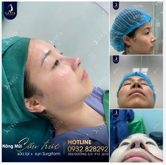 Bị chê là mũi phù thủy khiến em quá mệt mỏi