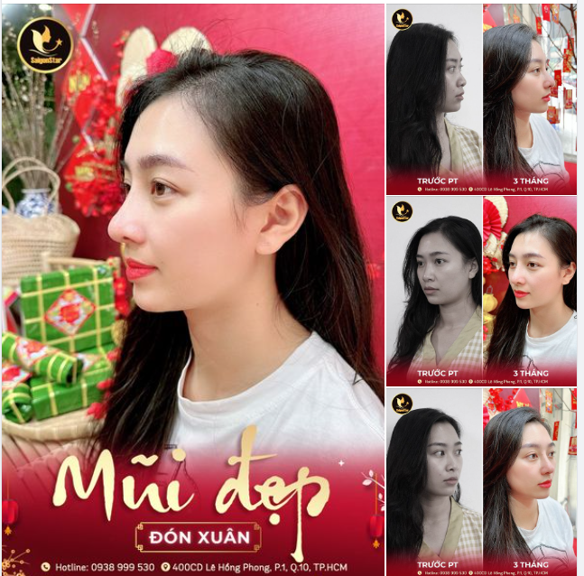 Có mai, có quất, có đào, có thêm mũi đẹp ngọt ngào cả năm 