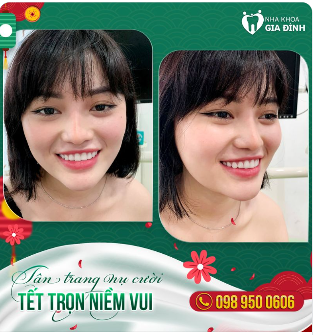 ĐẸP NGAY ĐÓN TẾT - GIÁP THÌN ĐẮC LỘC